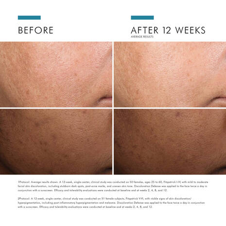 Skin Ceuticals Discolouration Defense