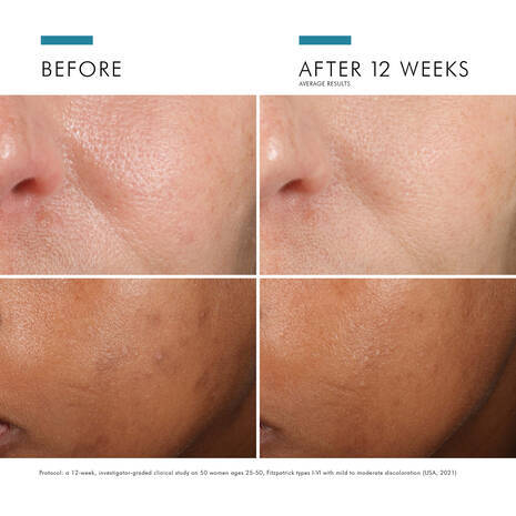 Skin Ceuticals Phloretin CF 30ml