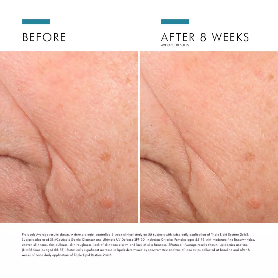 SkinCeuticals Triple Lipid Restore Face Cream