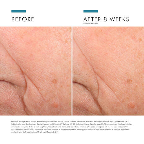 Skin Ceuticals Triple Lipid Repair