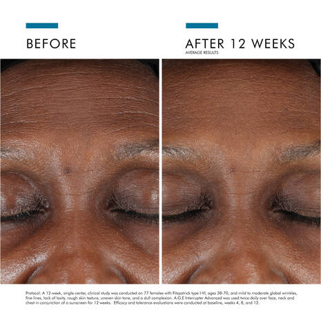 Skin Ceuticals A.G.E. Advanced