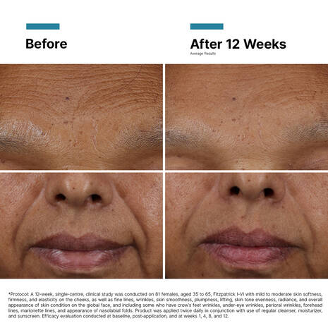 Skin Ceuticals HA Intensifier