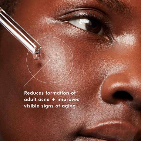 Skin Ceuticals Blemish and Age Defense 30ml
