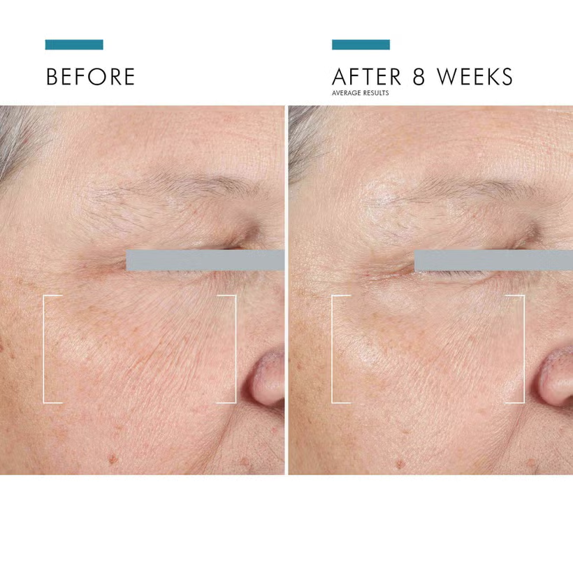 Skin Ceuticals A.G.E  Advanced Eye